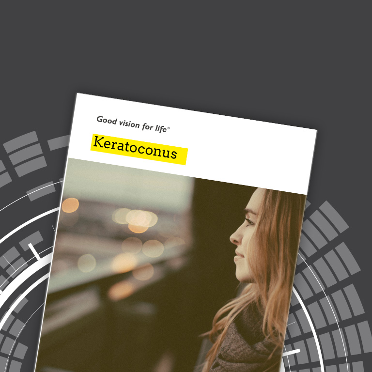 Keratoconus